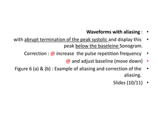 •
Waveforms with aliasing :
•
with abrupt termination of the peak systolic and display this
peak below the baseleine Sonogram.
•
Correction : @ increase the pulse repetition frequency
•
@ and adjust baseline (move down)
•
Figure 6 (a) & (b) : Example of aliasing and correction of the
aliasing.
•
Slides (10/11)
 
