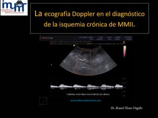 La ecografía Doppler en el diagnóstico
de la isquemia crónica de MMII.
drromelflores@hotmail.com
 