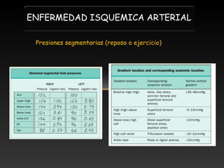 ENFERMEDAD ISQUEMICA ARTERIAL
Presiones segmentarias (reposo o ejercicio)

 