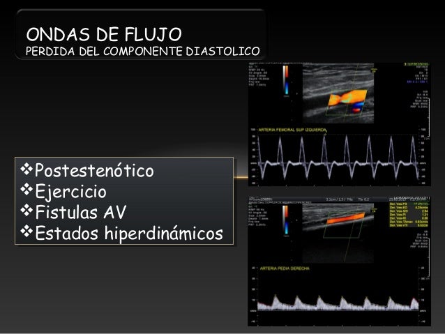 El aumento del miembro viril por la testosterona