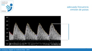 15
medicina
materno
fetal
HNDAC
E. Gratacos. Doppler en medicina fetal - 2010
adecuada frecuencia
emisión de pulsos
50 -70%
 
