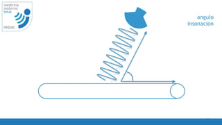 16
medicina
materno
fetal
HNDAC
angulo
insonacion
 