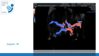 19
medicina
materno
fetal
HNDAC
doppler 3D
 