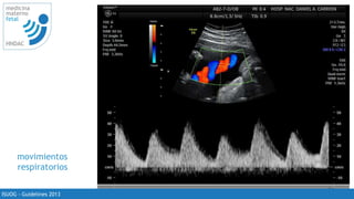 21
medicina
materno
fetal
HNDAC
ISUOG - Guidelines 2013
movimientos
respiratorios
 