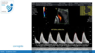 25
medicina
materno
fetal
HNDAC
ISUOG - Guidelines 2013
corregido
 