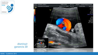 26
medicina
materno
fetal
HNDAC
ISUOG - Guidelines 2013
disminuir
ganancia 2D
 