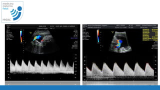 35
medicina
materno
fetal
HNDAC
 
