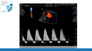 39
medicina
materno
fetal
HNDAC
 