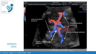 48
medicina
materno
fetal
HNDAC
E. Gratacos. Doppler en medicina fetal - 2010
poligono
willis
Arteria Cerebral
media
Arteria Cerebral anterior
Arteria Cerebral
posterior
Arteria comunicante
posterior
 