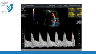 53
medicina
materno
fetal
HNDAC
 