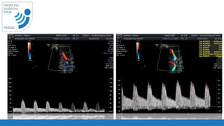 54
medicina
materno
fetal
HNDAC
 