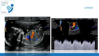 60
medicina
materno
fetal
HNDAC
utilidad
 