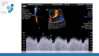 67
medicina
materno
fetal
HNDAC
 