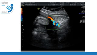 76
medicina
materno
fetal
HNDAC
 