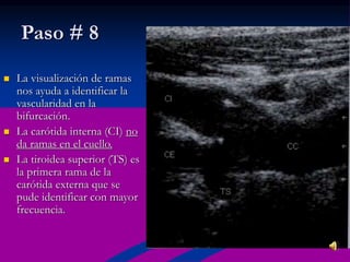 Paso # 8
 La visualización de ramas
nos ayuda a identificar la
vascularidad en la
bifurcación.
 La carótida interna (CI) no
da ramas en el cuello.
 La tiroidea superior (TS) es
la primera rama de la
carótida externa que se
pude identificar con mayor
frecuencia.
 