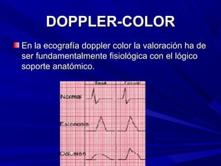 Doppler Color Pages Doppler color | PPT