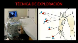 TÉCNICA	
  DE	
  EXPLORACIÓN
 