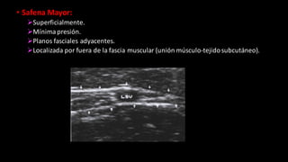 • Safena	
  Mayor:
ØSuperficialmente.
ØMínima	
  presión.
ØPlanos	
  fasciales	
  adyacentes.
ØLocalizada	
  por	
  fuera	
  de	
  la	
  fascia	
  muscular	
  (unión	
  músculo-­‐tejido	
  subcutáneo).
 