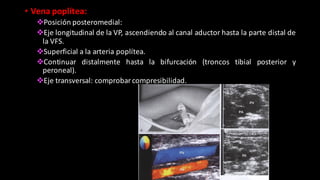 • Vena poplítea:
vPosición posteromedial:
vEje longitudinal de la VP, ascendiendo al canal aductor hasta la parte distal de
la VFS.
vSuperficial a la arteria poplítea.
vContinuar distalmente hasta la bifurcación (troncos tibial posterior y
peroneal).
vEje transversal: comprobar compresibilidad.
 
