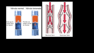 Las venas son más numerosas que las arterias, pues en muchas regiones, como en los
miembros, cada arteria va acompañada de dos venas; solamente los gruesos troncos
arteriales poseen un solo tronco venoso acompañante. Además, existen debajo de los
tegumentos intrines las redes venosas que constituyen el sistema venoso superficial, el
cual se anastomosa ampliamente con el sistema venoso profundo.
 