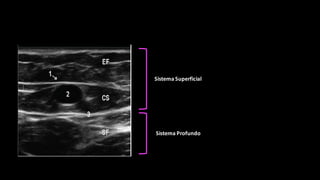 Sistema	
  Superficial	
  
Sistema	
  Profundo	
  
 