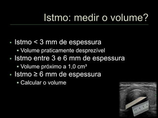  Istmo < 3 mm de espessura
 Volume praticamente desprezível
 Istmo entre 3 e 6 mm de espessura
 Volume próximo a 1,0 cm³
 Istmo ≥ 6 mm de espessura
 Calcular o volume
 