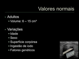  Adultos
 Volume: 6 – 15 cm³
 Variações
 Idade
 Sexo
 Superfície corpórea
 Ingestão de iodo
 Fatores genéticos
 