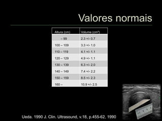 Ueda. 1990 J. Clin. Ultrasound, v.18, p.455-62, 1990
Altura (cm) Volume (cm³)
– 99 2.3 +/- 0.7
100 – 109 3.3 +/- 1.0
110 – 119 4.1 +/- 1.1
120 – 129 4.9 +/- 1.1
130 – 139 6.3 +/- 2.0
140 – 149 7.4 +/- 2.2
150 – 159 8.5 +/- 2.3
160 – 10.9 +/- 2.5
 