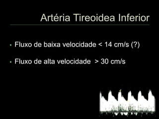  Fluxo de baixa velocidade < 14 cm/s (?)
 Fluxo de alta velocidade > 30 cm/s
 