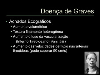  Achados Ecográficos
 Aumento volumétrico
 Textura finamente heterogênea
 Aumento difuso da vascularização
(Inferno Tireoideano - Ralls 1988)
 Aumento das velocidades de fluxo nas artérias
tireóideas (pode superar 50 cm/s)
 