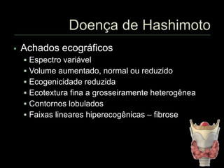  Achados ecográficos
 Espectro variável
 Volume aumentado, normal ou reduzido
 Ecogenicidade reduzida
 Ecotextura fina a grosseiramente heterogênea
 Contornos lobulados
 Faixas lineares hiperecogênicas – fibrose
 