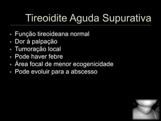  Função tireoideana normal
 Dor à palpação
 Tumoração local
 Pode haver febre
 Área focal de menor ecogenicidade
 Pode evoluir para a abscesso
 