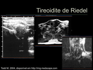 Todd M. 2004, disponível em http://img.medscape.com
 