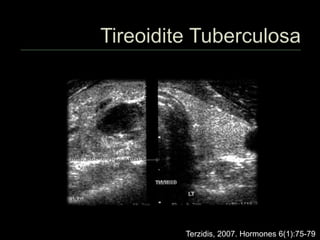 Terzidis, 2007. Hormones 6(1):75-79
 