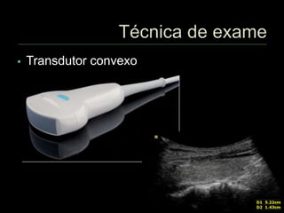  Transdutor convexo
 