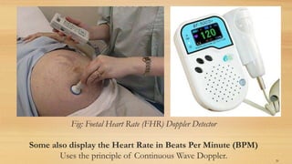 Fig: Foetal Heart Rate (FHR) Doppler Detector
Some also display the Heart Rate in Beats Per Minute (BPM)
Uses the principle of Continuous Wave Doppler. 26
 