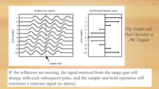 Fig: Sample-and-
Hold Operation of
PW Doppler
37
If the reflectors are moving, the signal received from the range gate will
change with each subsequent pulse, and the sample-and-hold operation will
construct a staircase signal (as above).
 