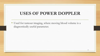 USES OF POWER DOPPLER
• Used for tumour imaging, where moving blood volume is a
diagnostically useful parameter.
63
 
