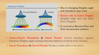 • Due to changing Doppler angle
and transducer type used.
• Occurs only in Colour Doppler
(Doppler angle does not affect
Power Doppler)
• It can lead to Reverse-Flow and
Flow Acceleration artifacts.
85
• Convex/Sector Transducer & Linear Vessels: Curved transducer aperture
introduces Doppler angles, causing inaccurate depiction of blood vessel velocities.
• Linear Transducer & Curved Vessels: Produces similar effect as the above.
 