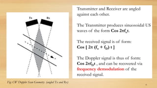 Doppler Effect - Ultrasound