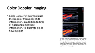 Doppler Color Pages DOPPLER FLOW IMAGING AND SPECTRAL ANALYSIS.pptx