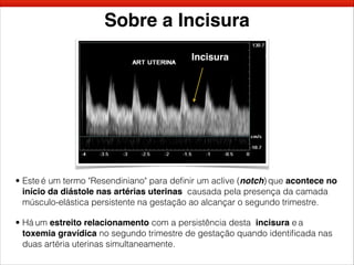 Sobre a Incisura
• Este é um termo "Resendiniano" para deﬁnir um aclive (notch) que acontece no
início da diástole nas artérias uterinas causada pela presença da camada
músculo-elástica persistente na gestação ao alcançar o segundo trimestre.
• Há um estreito relacionamento com a persistência desta incisura e a
toxemia gravídica no segundo trimestre de gestação quando identiﬁcada nas
duas artéria uterinas simultaneamente.
Incisura
 