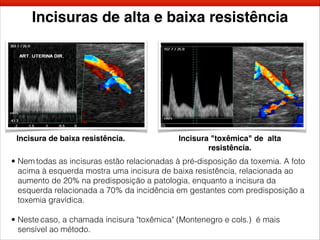 Incisuras de alta e baixa resistência
• Nem todas as incisuras estão relacionadas à pré-disposição da toxemia. A foto
acima à esquerda mostra uma incisura de baixa resistência, relacionada ao
aumento de 20% na predisposição a patologia, enquanto a incisura da
esquerda relacionada a 70% da incidência em gestantes com predisposição a
toxemia gravídica.
• Neste caso, a chamada incisura "toxêmica" (Montenegro e cols.) é mais
sensível ao método.
Incisura de baixa resistência. Incisura "toxêmica" de alta
resistência.
 