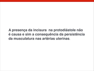 A presença da incisura na protodiástole não
é causa e sim a consequência da persistência
da musculatura nas artérias uterinas.
 