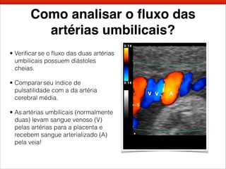 Como analisar o ﬂuxo das
artérias umbilicais?
• Veriﬁcar se o ﬂuxo das duas artérias
umbilicais possuem diástoles
cheias.
• Comparar seu índice de
pulsatilidade com a da artéria
cerebral média.
• As artérias umbilicais (normalmente
duas) levam sangue venoso (V)
pelas artérias para a placenta e
recebem sangue arterializado (A)
pela veia!
 