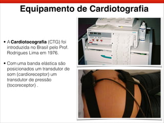 Equipamento de Cardiotograﬁa
• A Cardiotocograﬁa (CTG) foi
introduzida no Brasil pelo Prof.
Rodrigues Lima em 1976.
• Com uma banda elástica são
posicionados um transdutor de
som (cardioreceptor) um
transdutor de pressão
(tocoreceptor) .
 