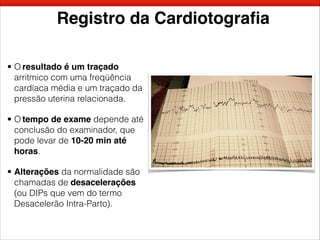 Registro da Cardiotograﬁa
• O resultado é um traçado
arritmico com uma freqüência
cardíaca média e um traçado da
pressão uterina relacionada.
• O tempo de exame depende até
conclusão do examinador, que
pode levar de 10-20 min até
horas.
• Alterações da normalidade são
chamadas de desacelerações
(ou DIPs que vem do termo
Desacelerão Intra-Parto).
 