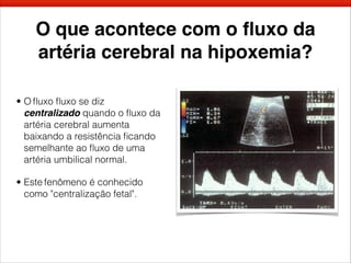 O que acontece com o ﬂuxo da
artéria cerebral na hipoxemia?
• O ﬂuxo ﬂuxo se diz
centralizado quando o ﬂuxo da
artéria cerebral aumenta
baixando a resistência ﬁcando
semelhante ao ﬂuxo de uma
artéria umbilical normal.
• Este fenômeno é conhecido
como "centralização fetal".
 