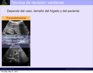 Técnica de revisión: ventanas

     • Depende del vaso, tamaño del hígado y del paciente

         Transabdominal




   Lóbulo izquierdo
   •     Porta izquierda
   •     VSH izq




incich/grupo ct scanner                          Departamento de Radiología/Unidad PET-CT

Thursday, May 31, 2012
 