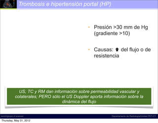 Trombosis e hipertensión portal (HP)



                                                  • Presión >30 mm de Hg
                                                    (gradiente >10)


                                                  • Causas:  del flujo o de
                                                    resistencia




                US, TC y RM dan información sobre permeabilidad vascular y
              colaterales; PERO sólo el US Doppler aporta información sobre la
                                     dinámica del flujo


incich/grupo ct scanner                                       Departamento de Radiología/Unidad PET-CT

Thursday, May 31, 2012
 